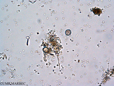 phyto/Thau_Lagoon/THAU_station1/GELAMED 2010/Coronosphaera mediterranea (2)(copy)_thumb.jpg